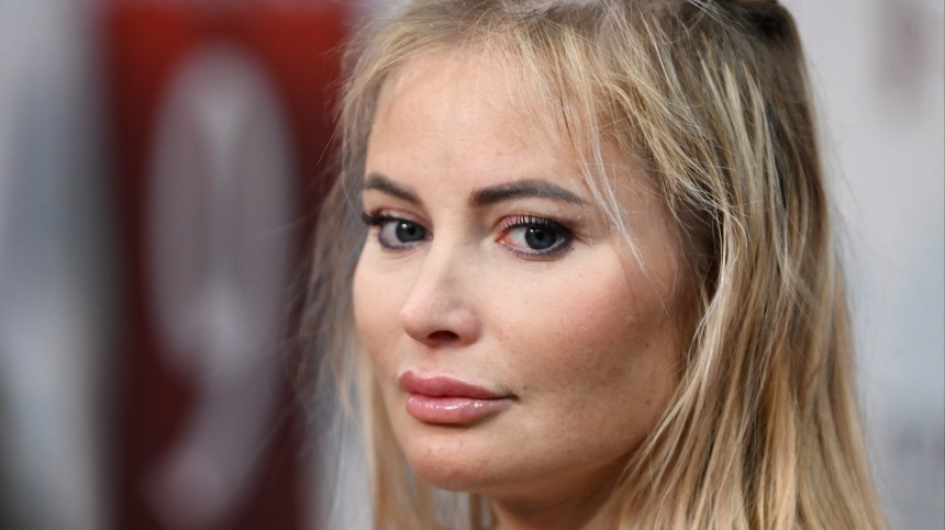 “Никогда не скрывала”: Дана Борисова показала шрамы на лице